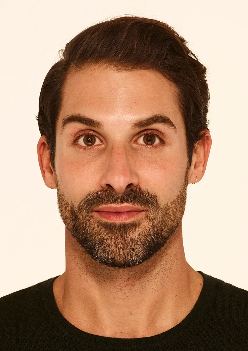 Stephen after BOTOX Cosmetic treatment